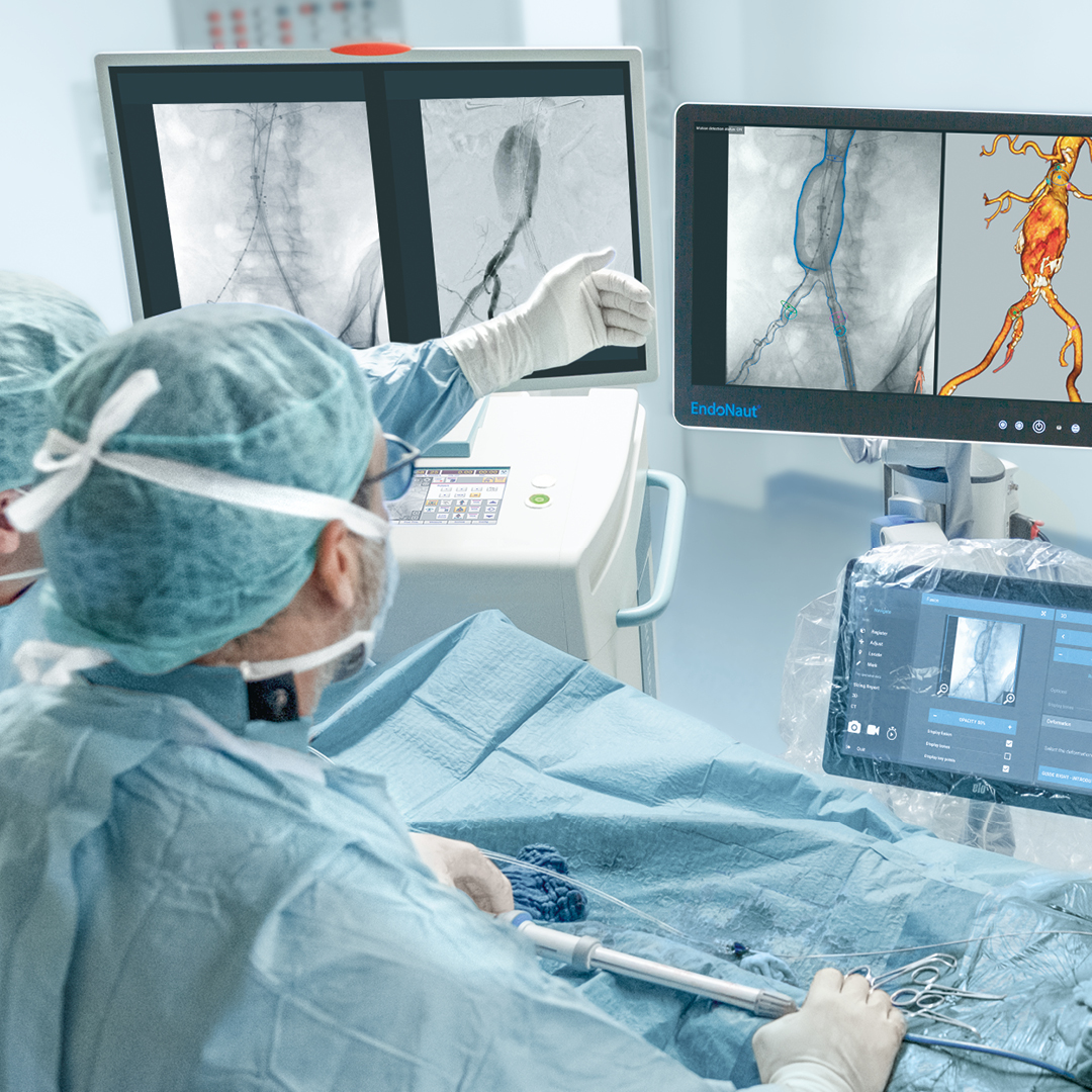 Endovascular case planning with Therenva EndoSize
