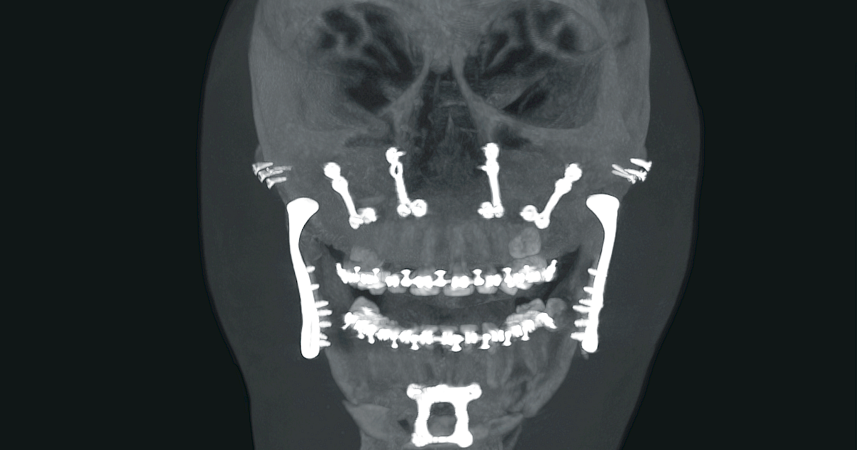 口腔及颌面外科- Ziehm Imaging | ZH