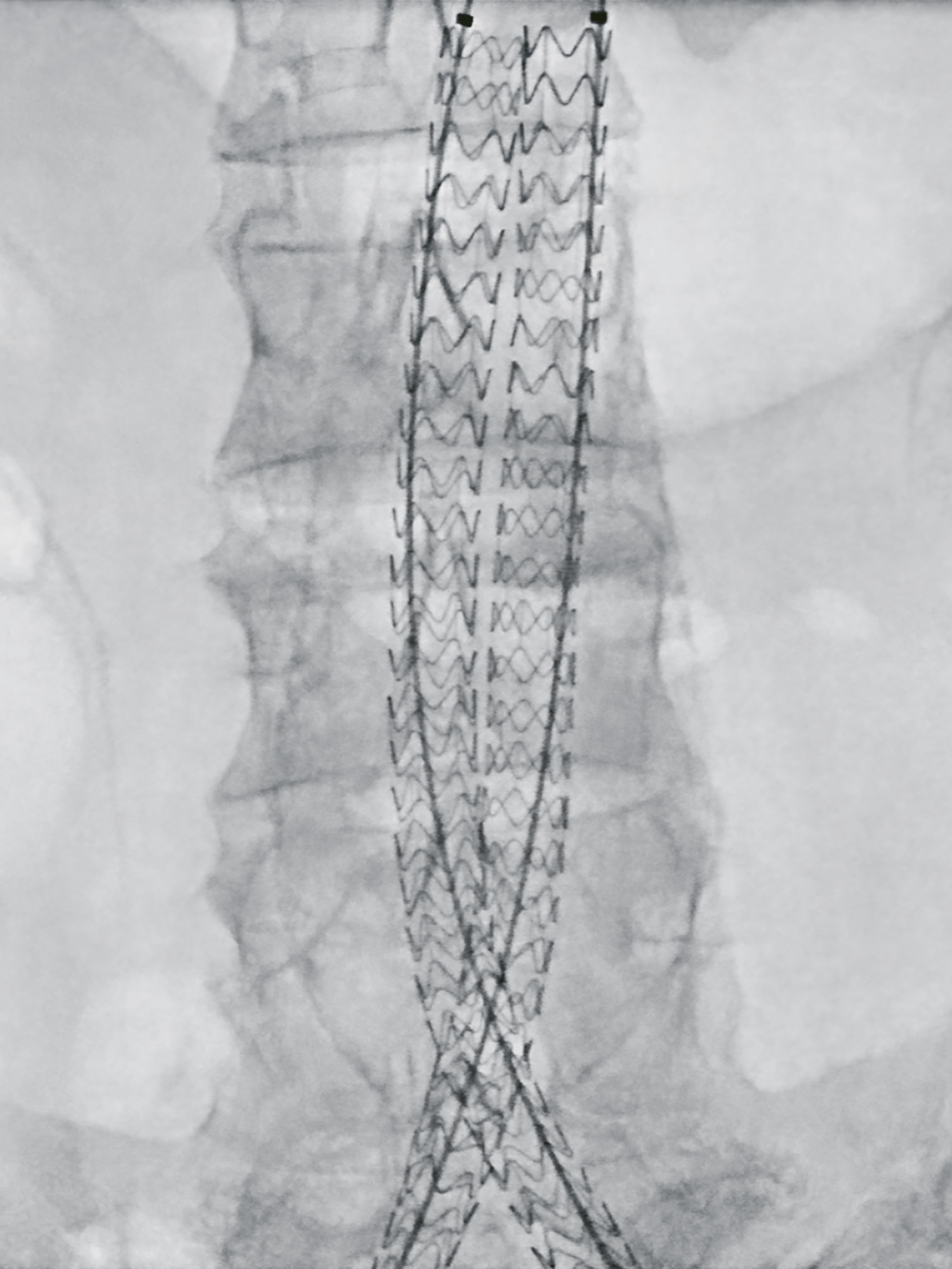 The image was generated with the Ziehm Vision RFD Hybrid Edition at the university hospital in Parma, Italy.