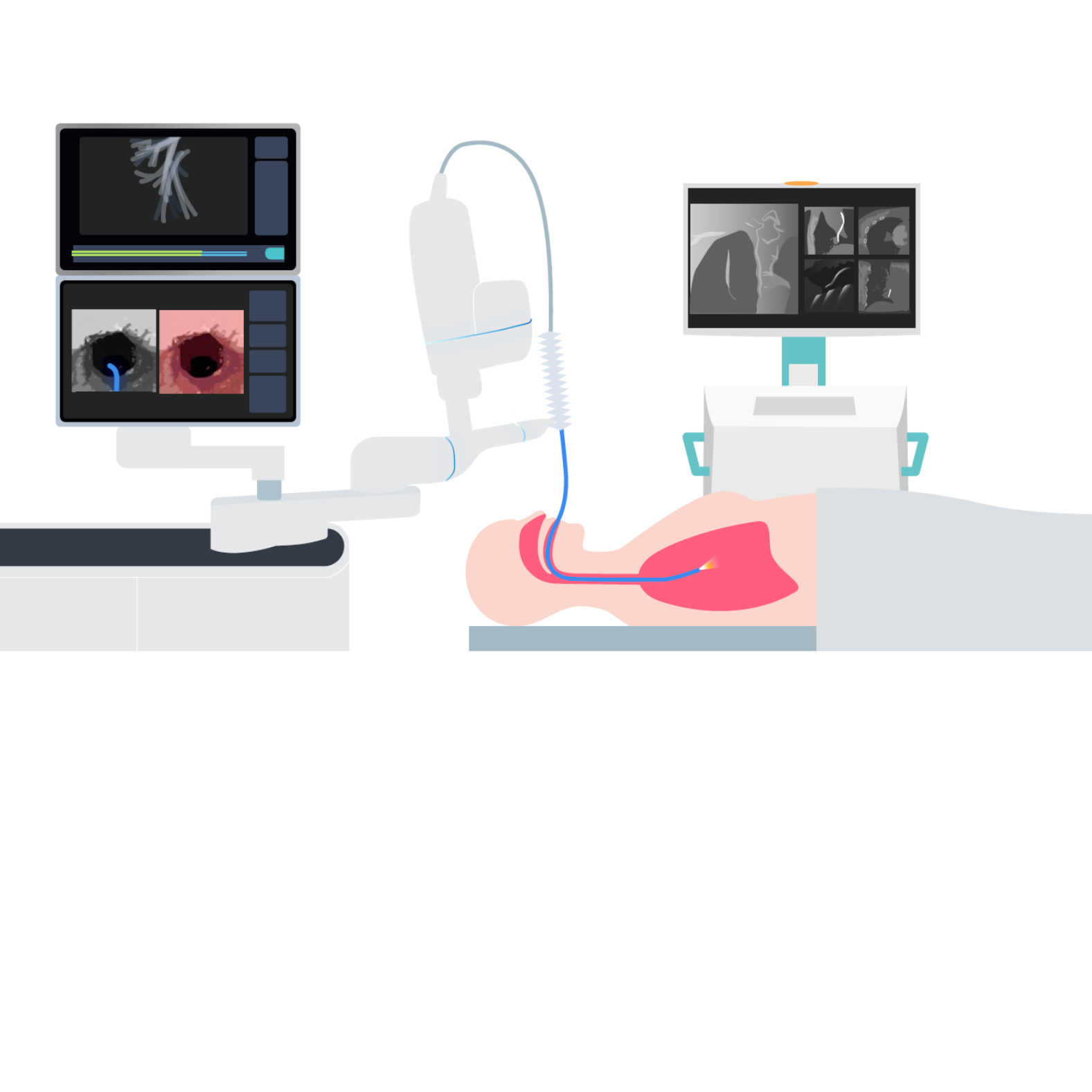 Ziehm Vision RFD 3D