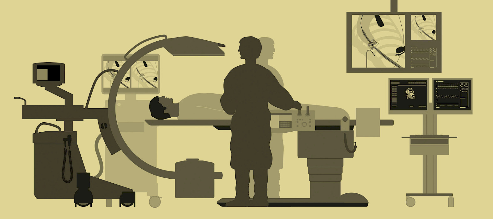 Illustration of a mobile cath lab