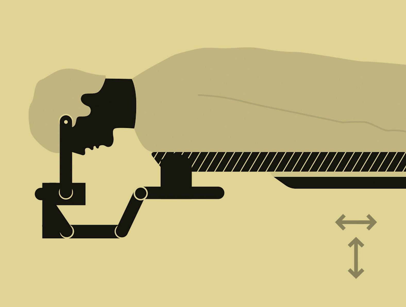Illustration of a patient lying face down on an operating table
