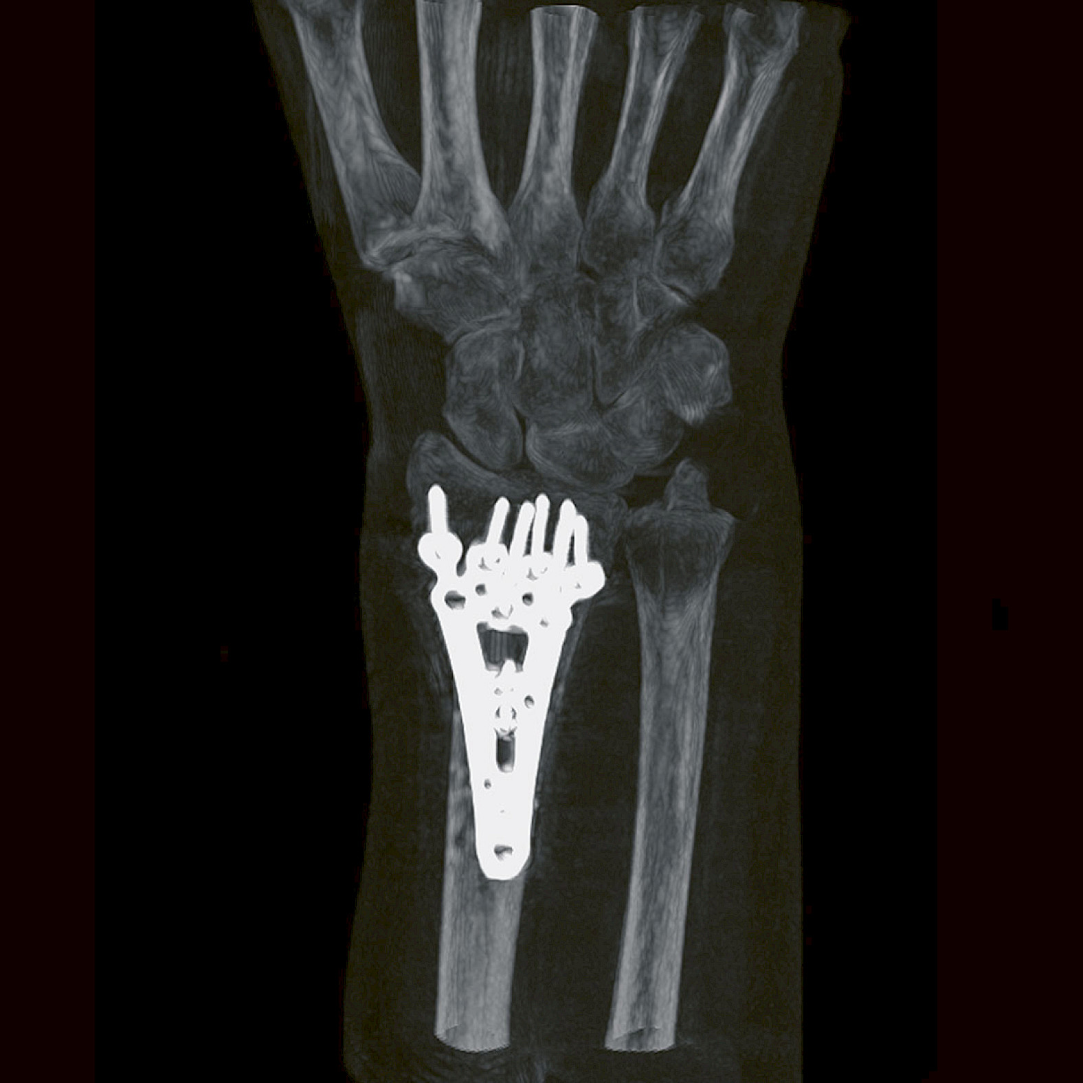 Clinical image hand surgery