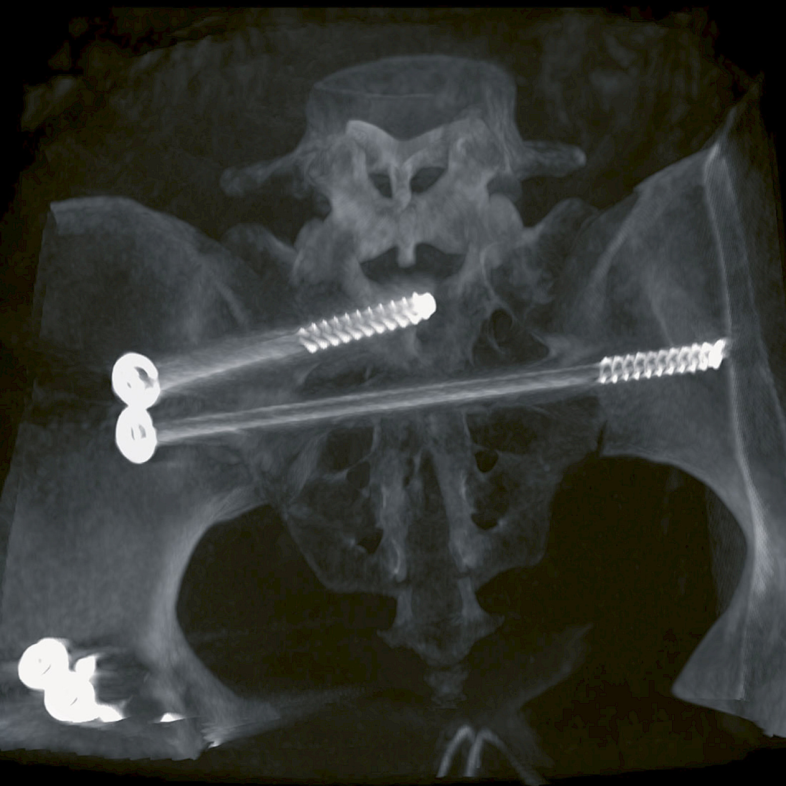 Cinical image pelvis surgery
