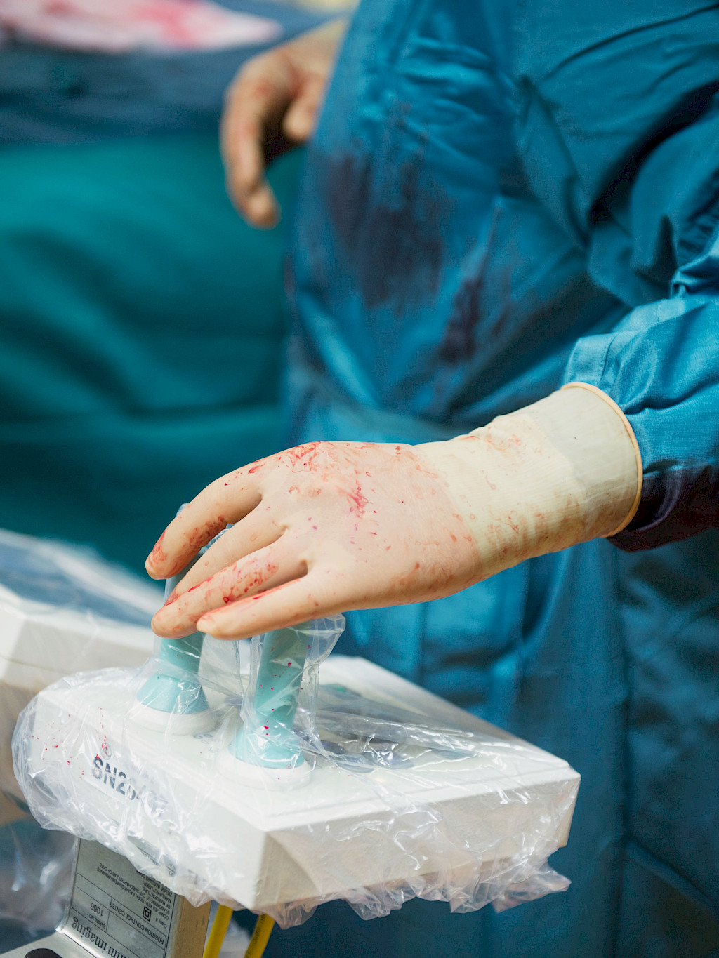 Zoom in on a hand wearing a rubber glove inside an operating room. The hand is controlling a joystick.