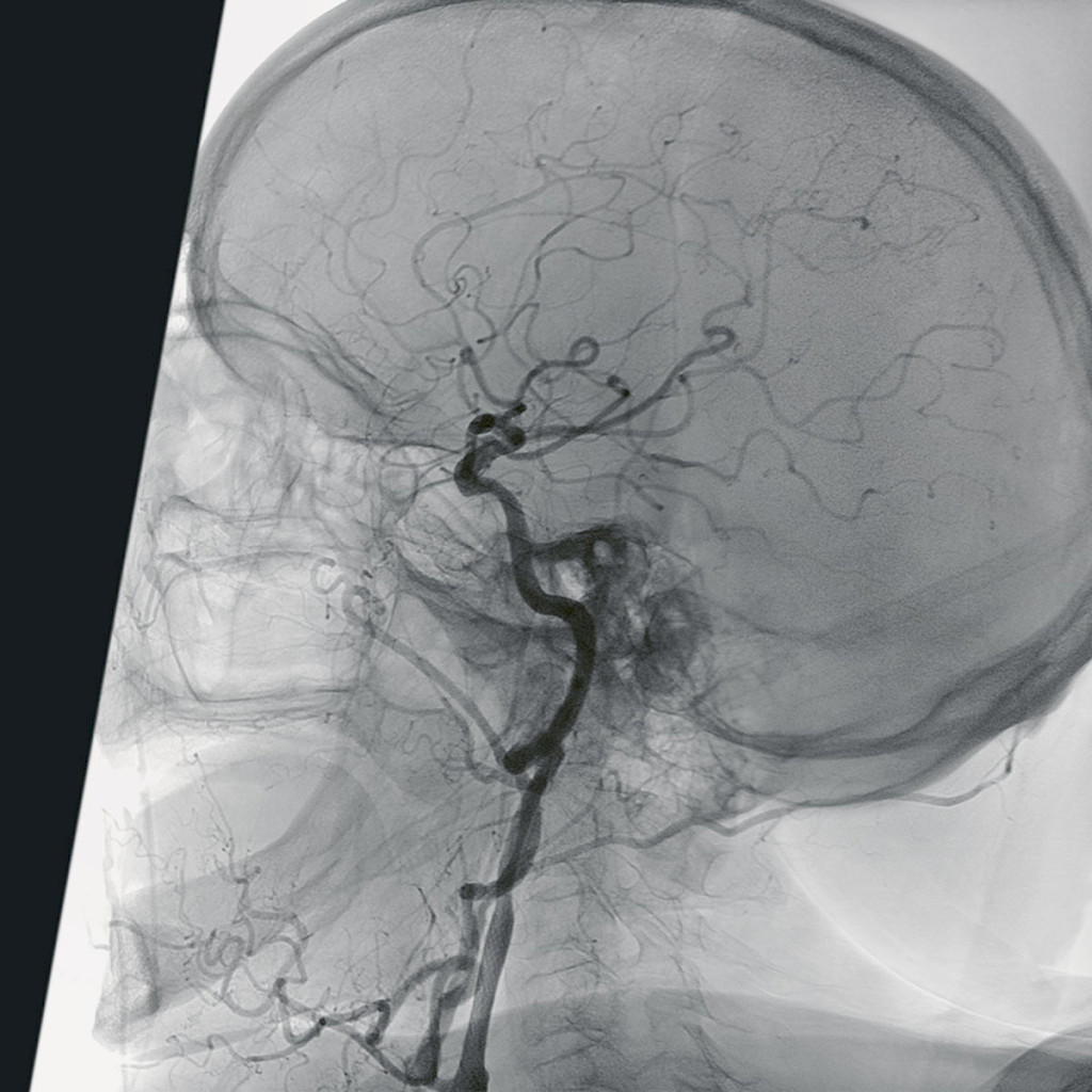 Native clinical image