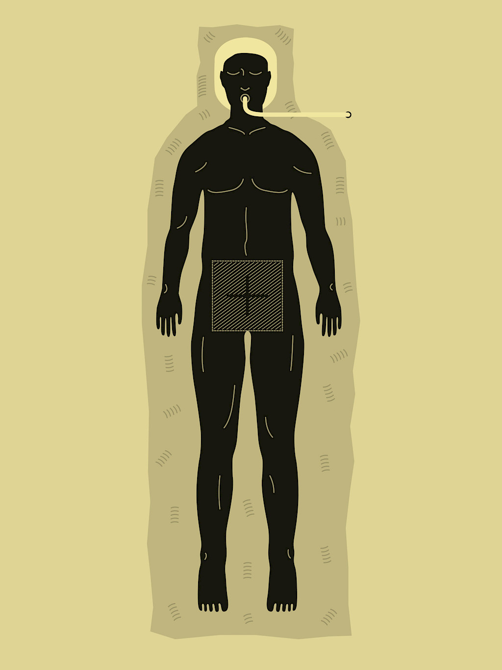 Illustration of a patient being prepared for a 3D scan