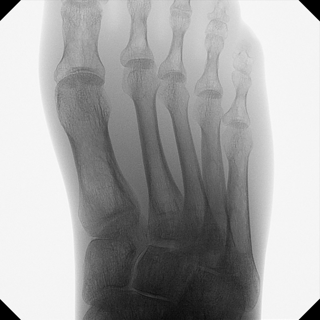 Chirurgie de la main et du pied