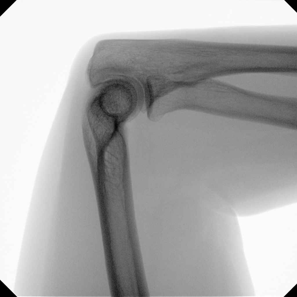 Orthopedics and Traumatology