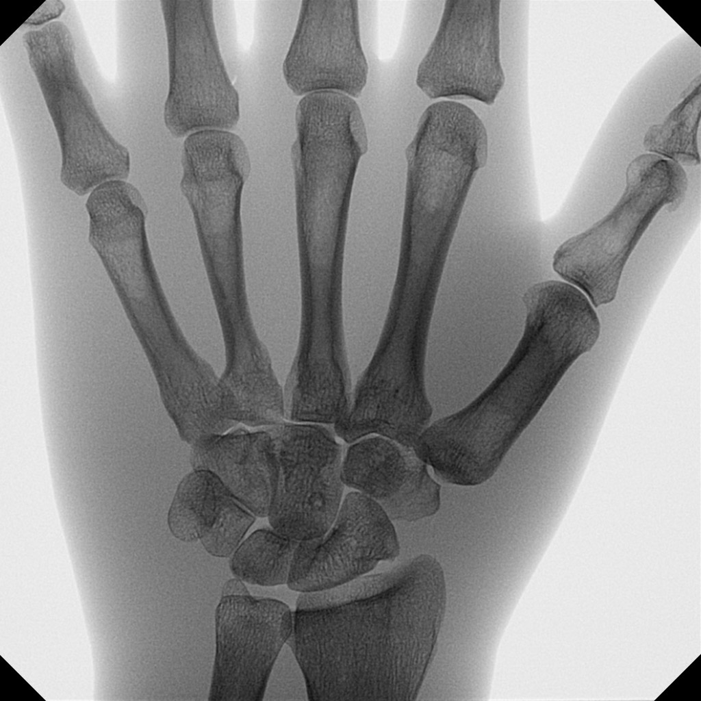 Chirurgie de la main et du pied