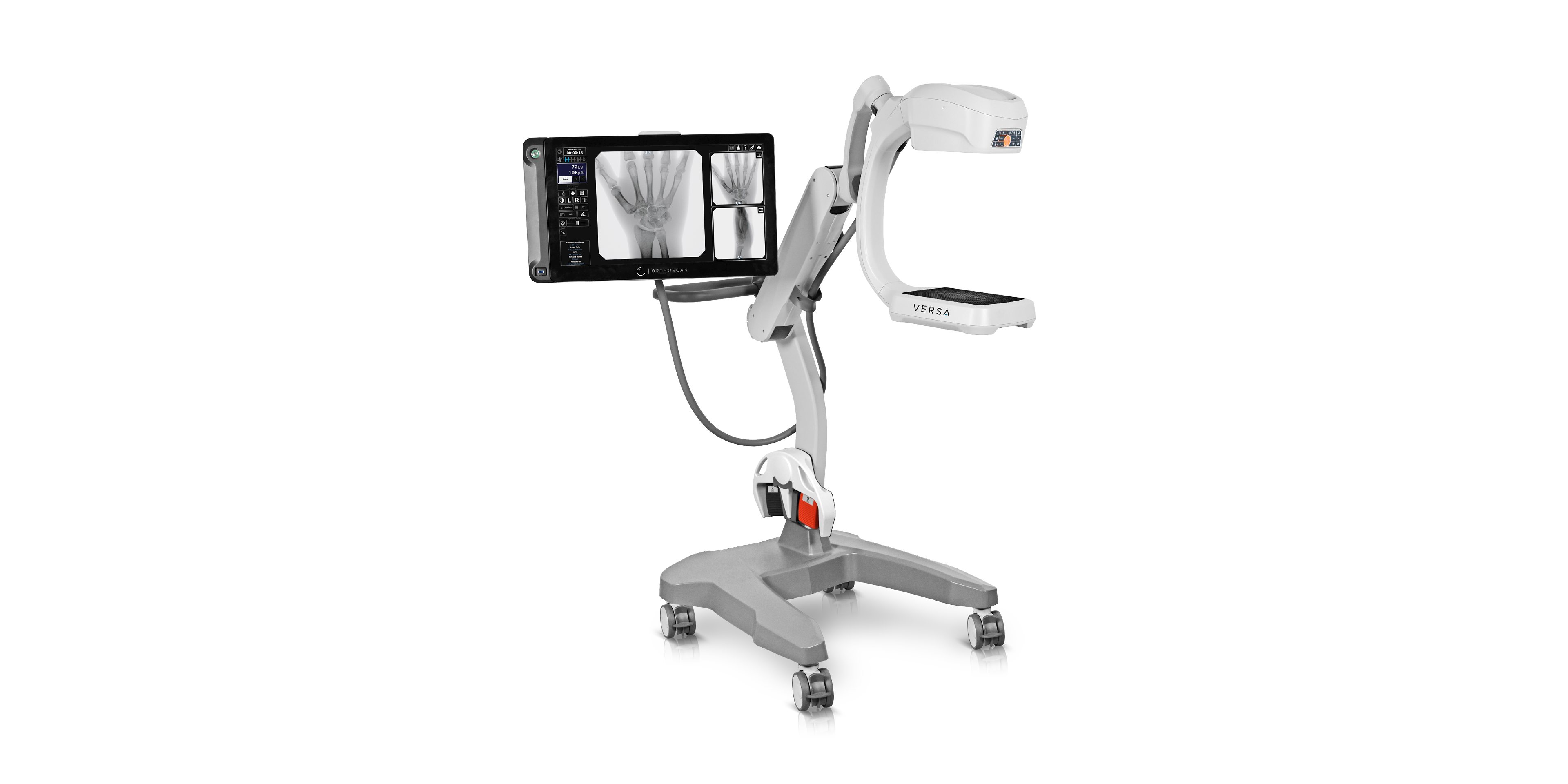 Orthoscan Versa