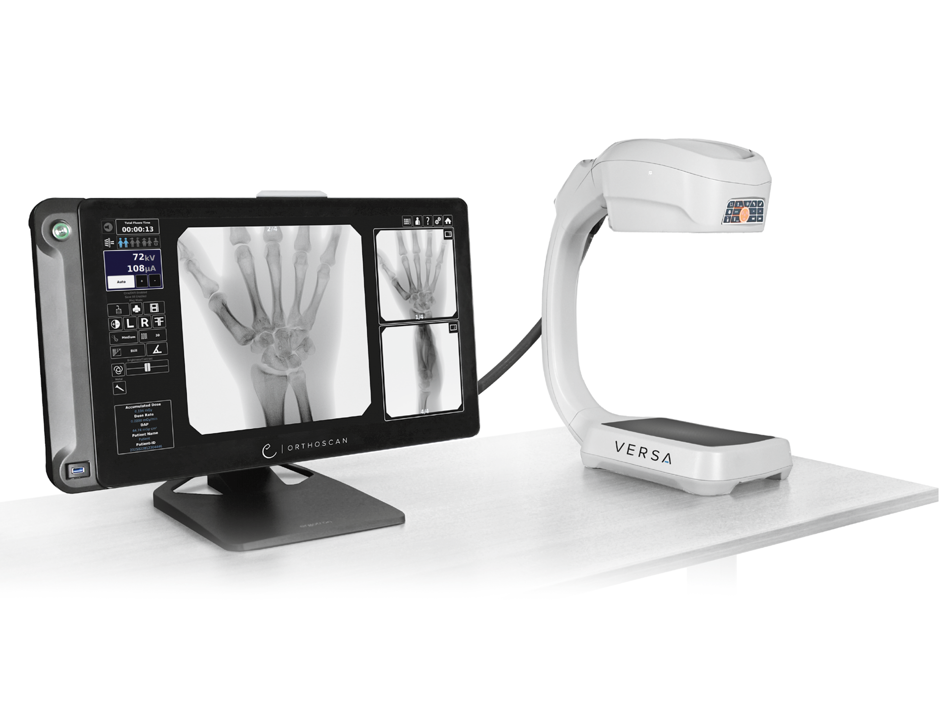 Orthoscan Versa