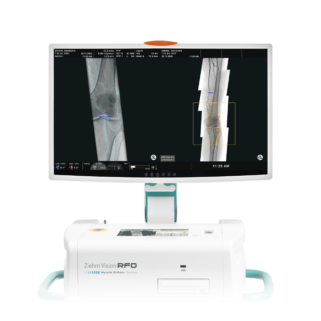 Endovascular Navigation Peripheral