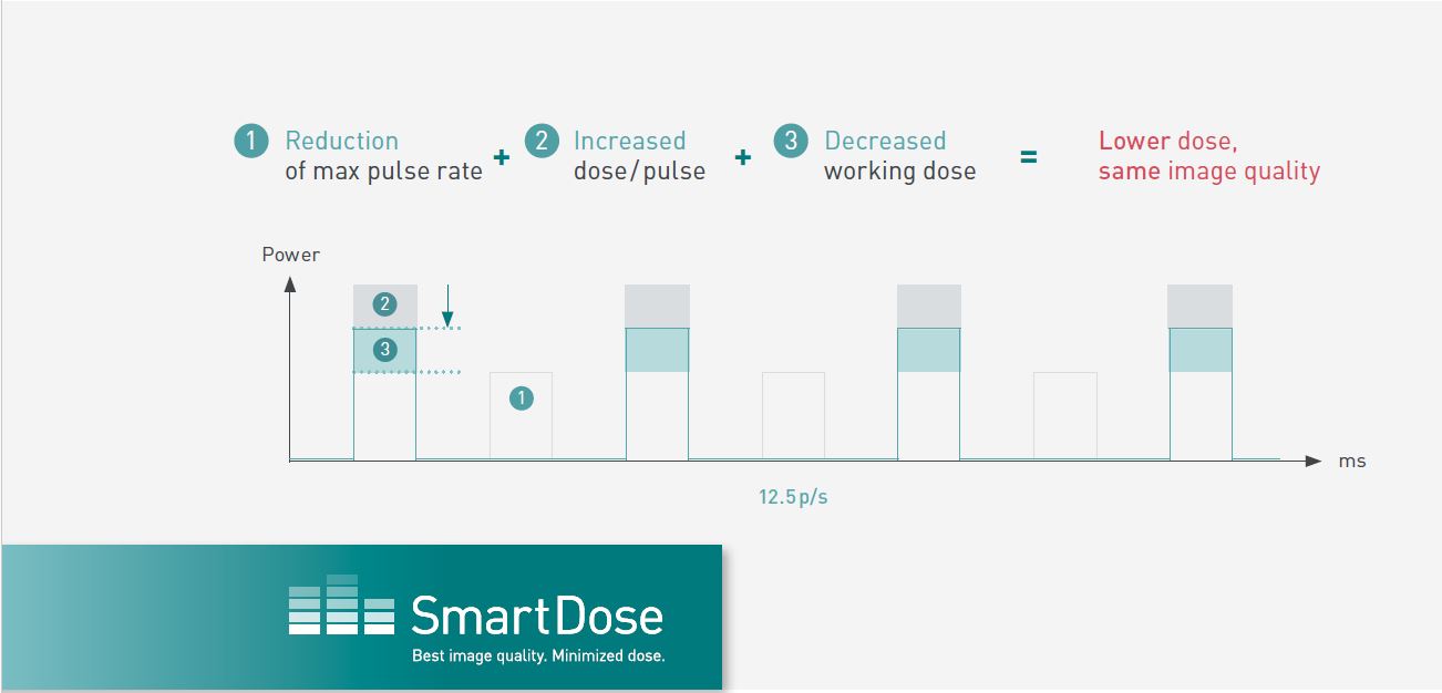Ziehm Vision RFD Hybrid Edition Cardio