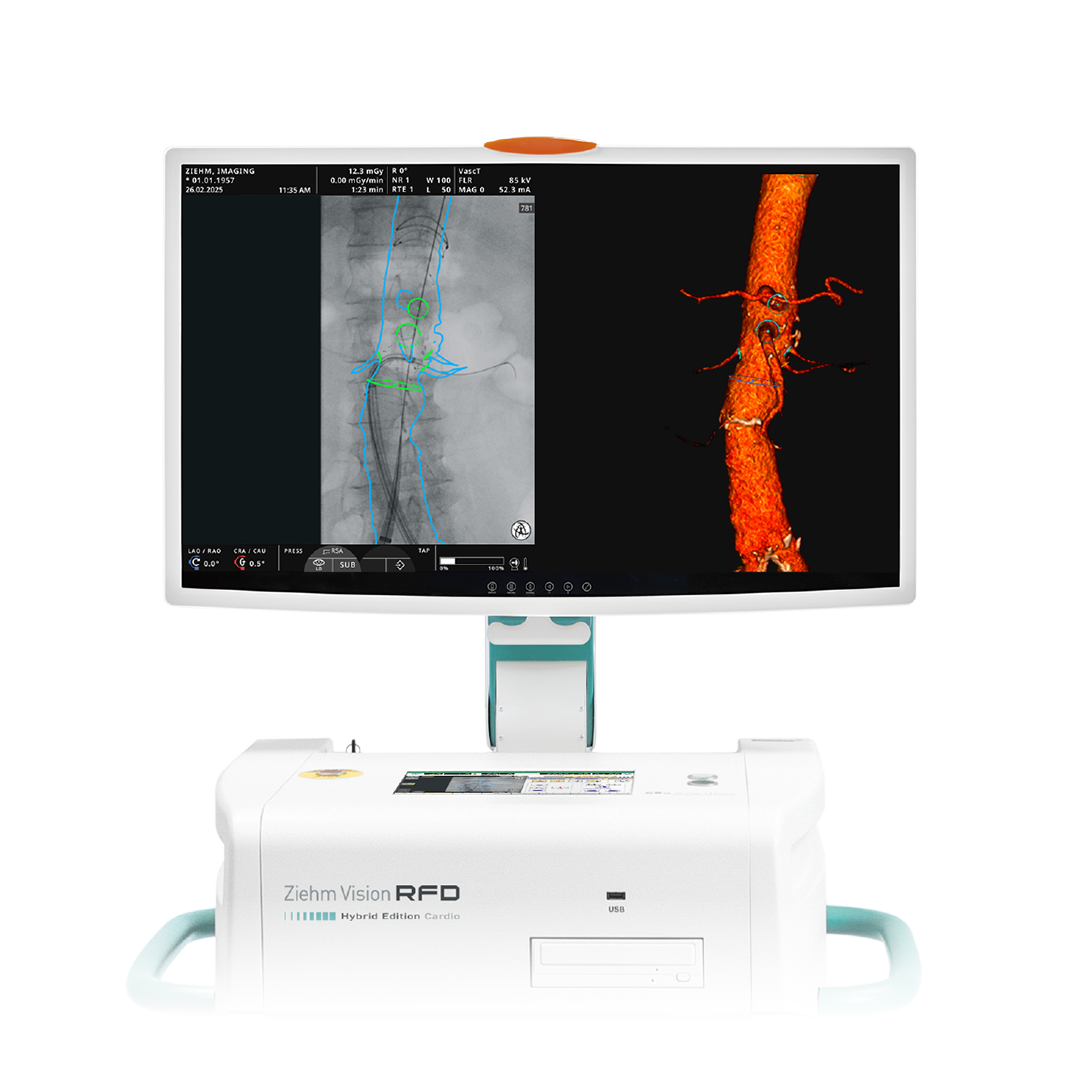Endovascular Navigation Aorto-iliac