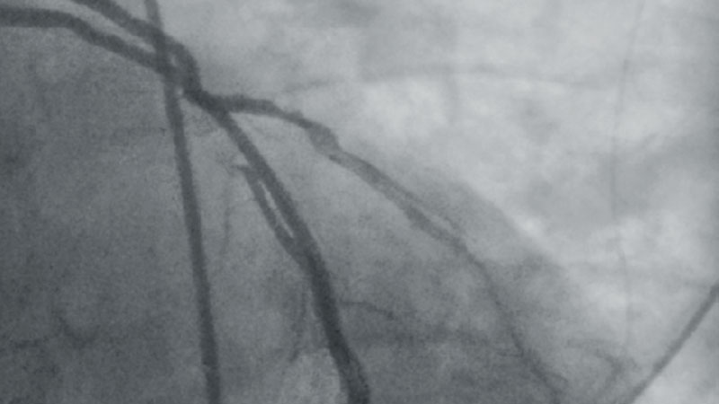 Ziehm Vision RFD Hybrid Edition