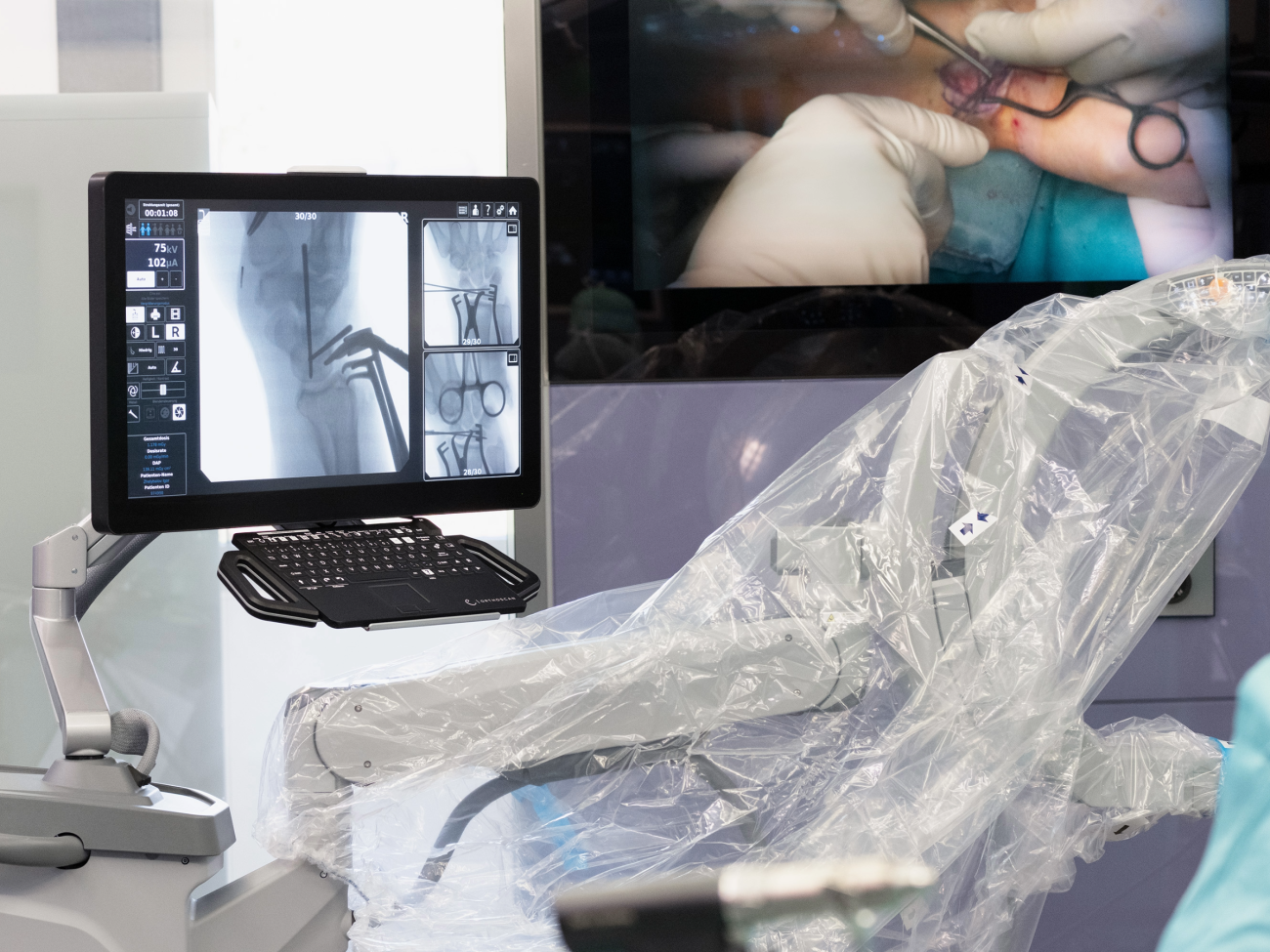 The Orthoscan Mini C-arm TAU 2020 is easy to maneuver and administers a particularly low radiation dose thanks to pulsed fluoroscopy.