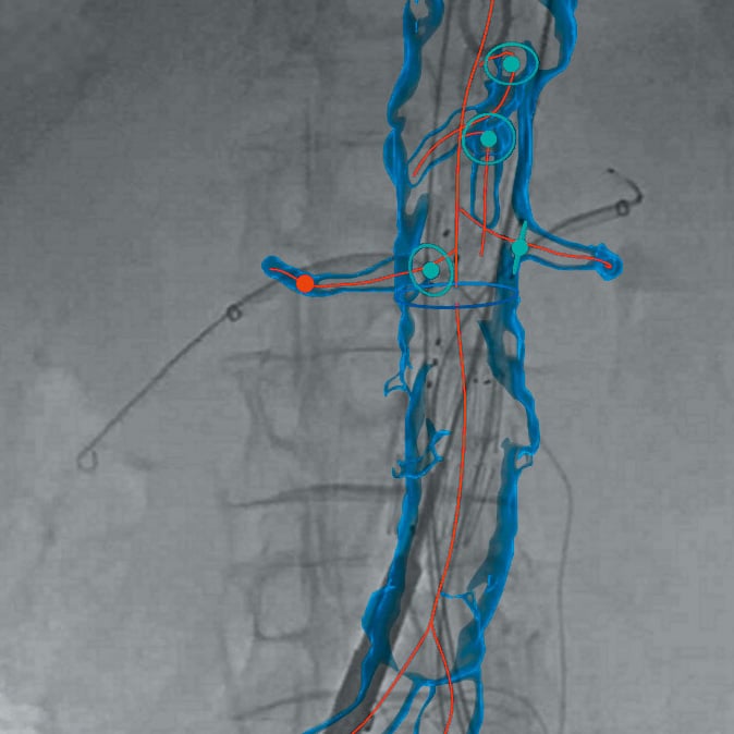 Cardiovascular Imaging