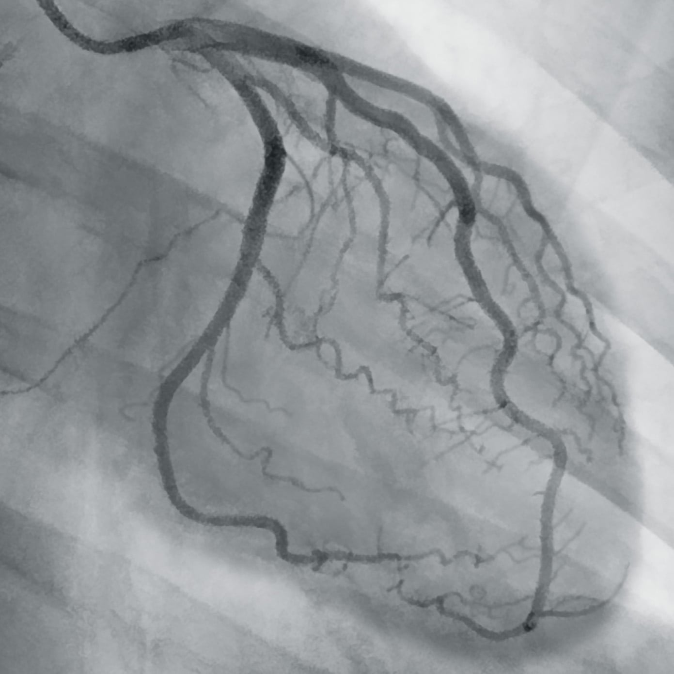 Cardiovascular Imaging