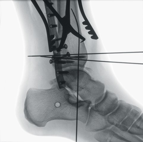 Orthopedics and Traumatology