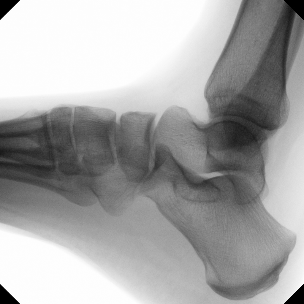 Hand and Foot surgery