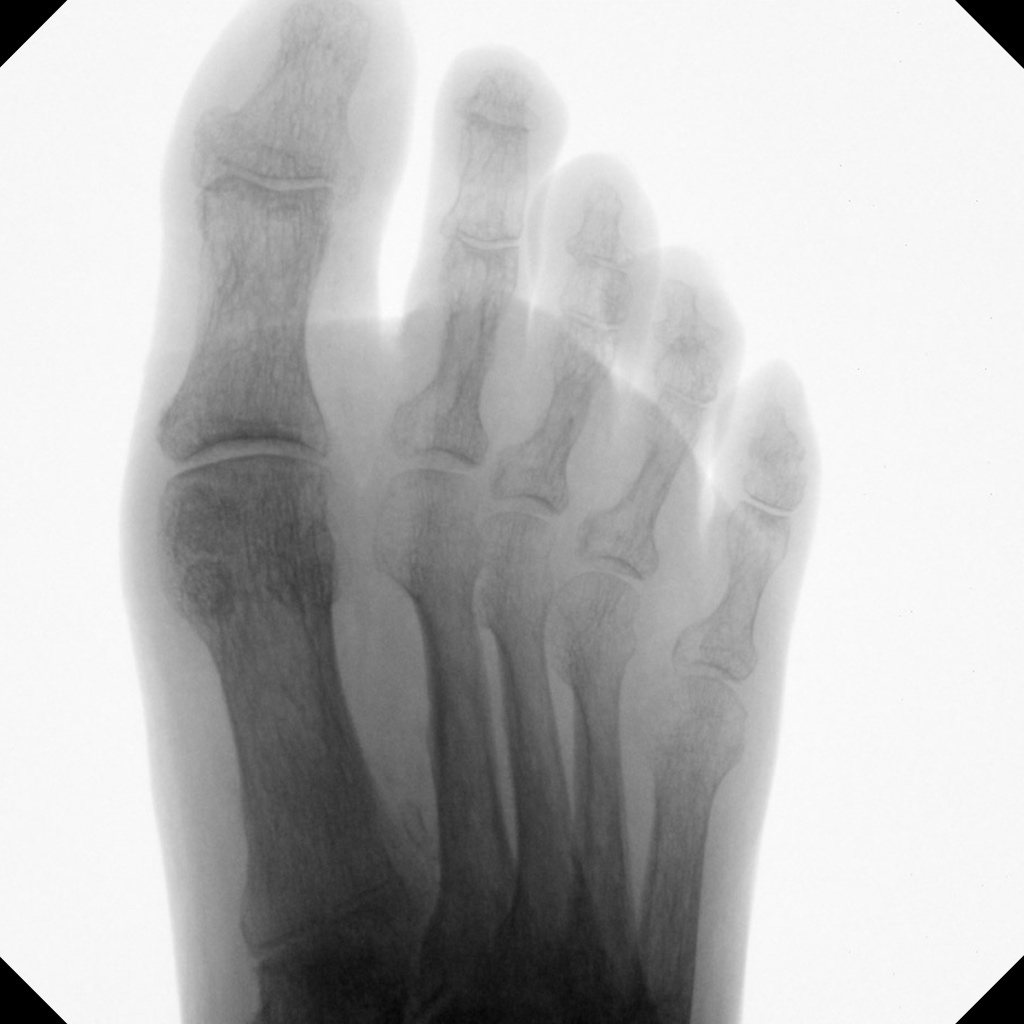 Hand and Foot surgery