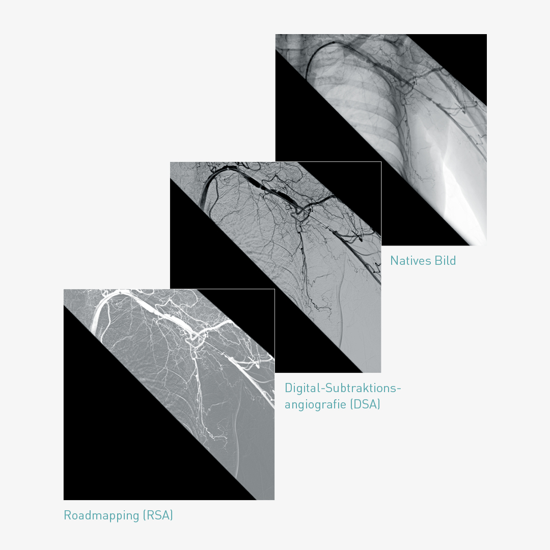 Flujo de trabajo SmartVascular