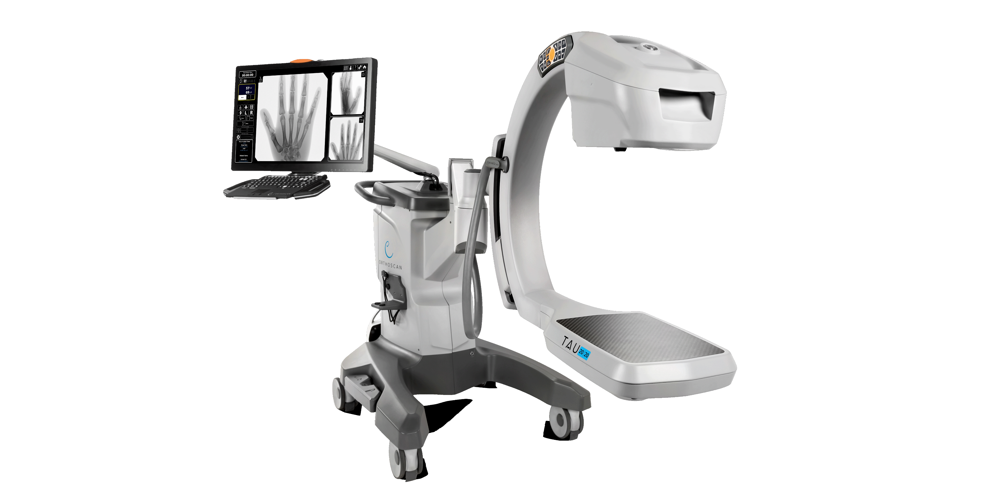 Orthoscan TAU 1512