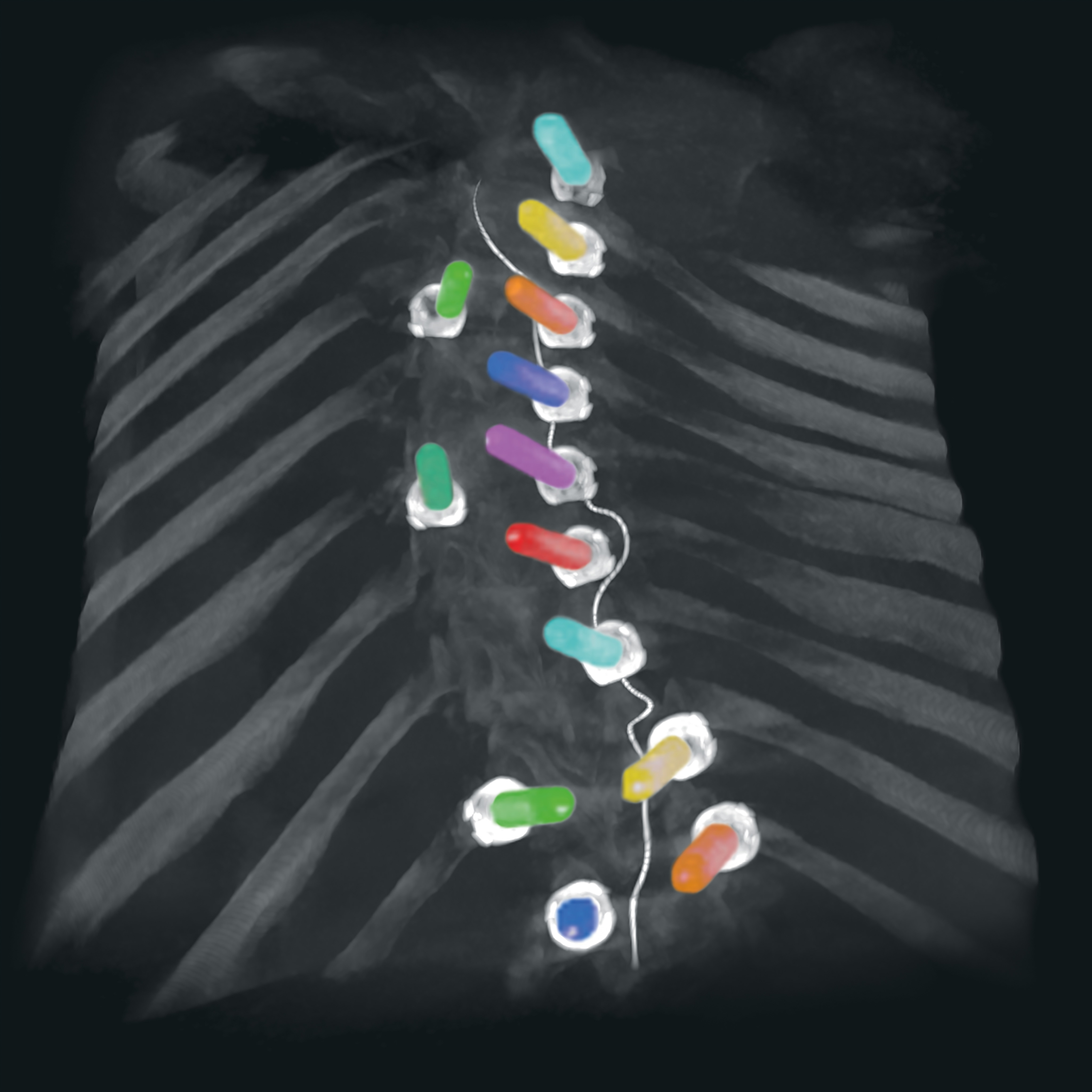 Cochlea-Paket und Zoom-in Funktion