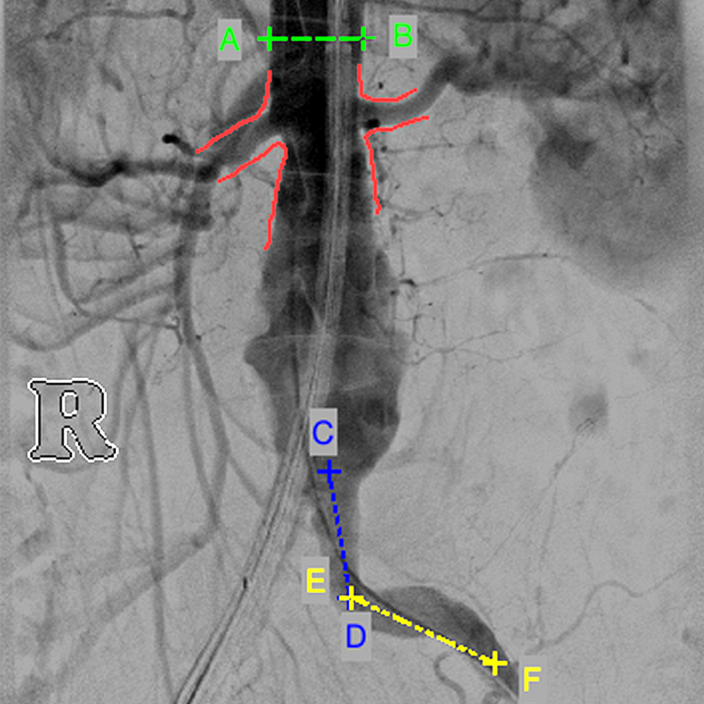 Cardio Vascular Packages