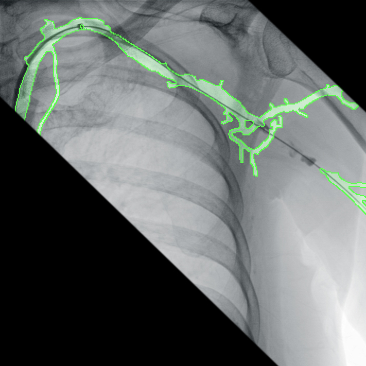 SmartVascular Workflow