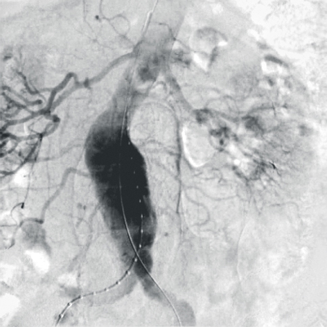 SmartVascular Workflow