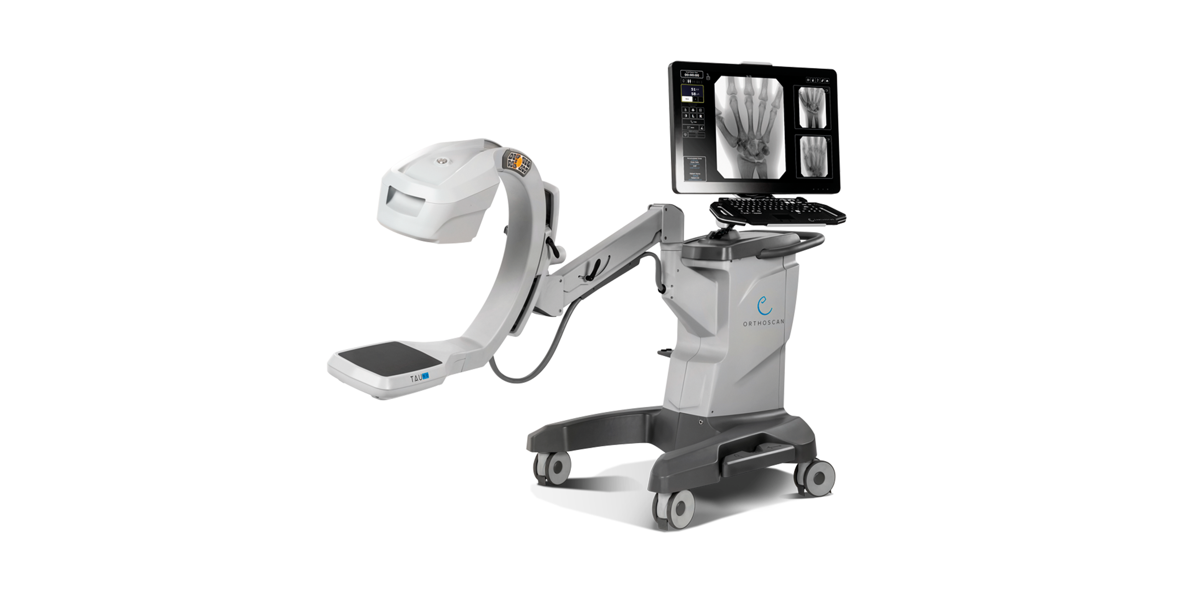 Orthoscan TAU 1512