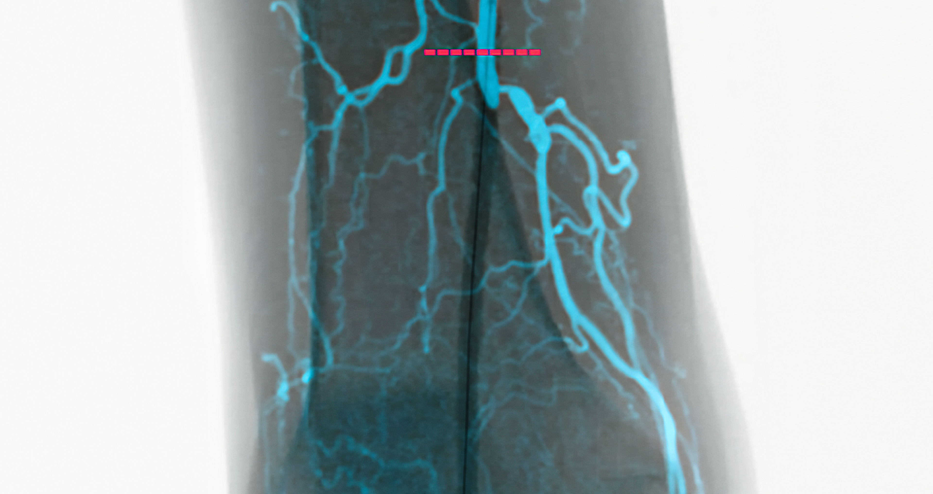 Vascular 3D Image Fusion with EndoNaut